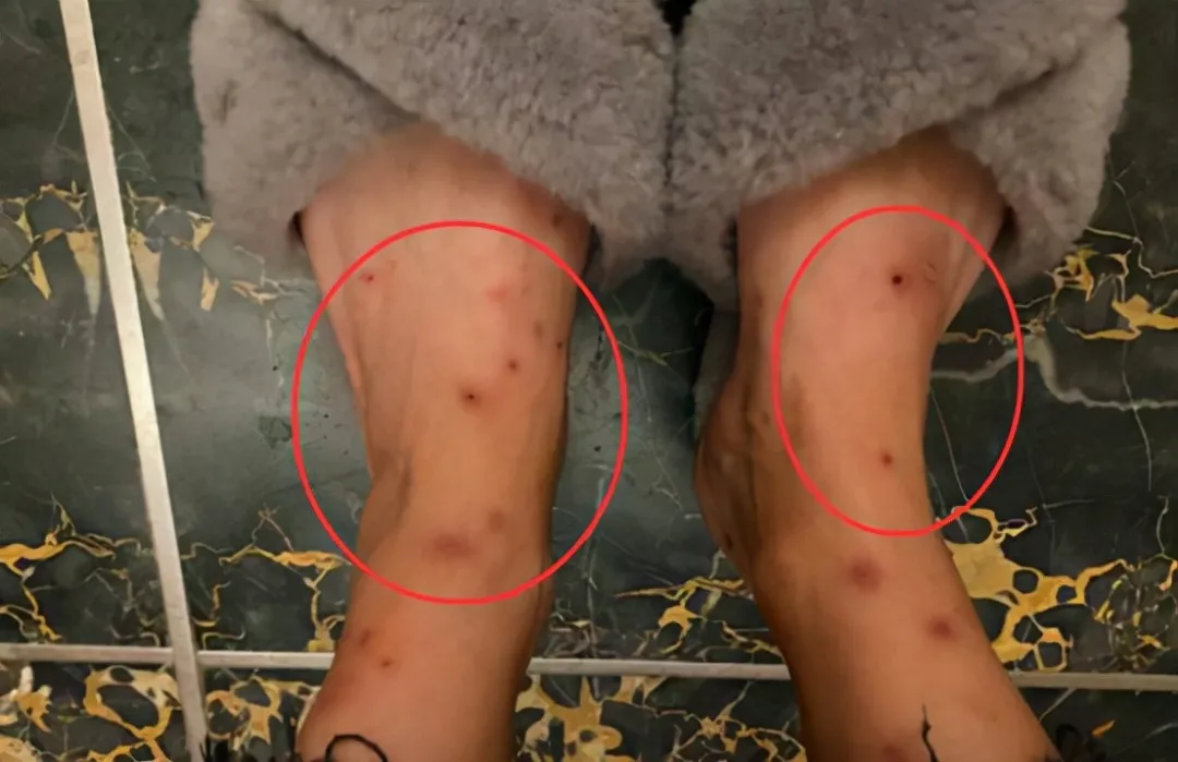 一小區跳蚤泛濫！跳蚤究（jiū）竟哪來的？